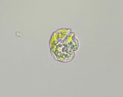 Microscopic photo of Karenia brevis, the dinoflagellate that causes most red tide.